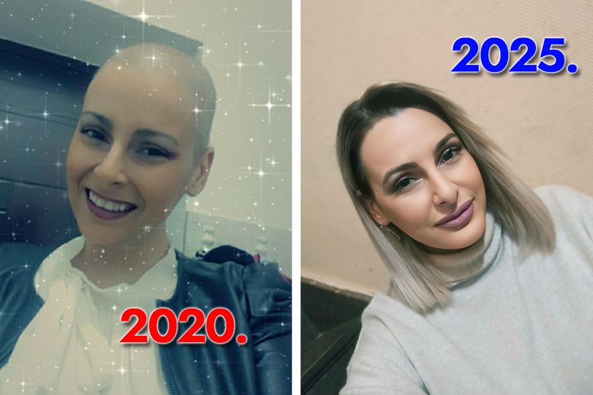 Jasmina prošla 31 zračenje i 16 kemoterapija, danas s ponosom kaže “Uspjela sam”: Ova slika je simbol pobjede